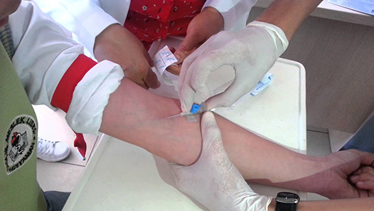 Serum Nasıl Takılır?